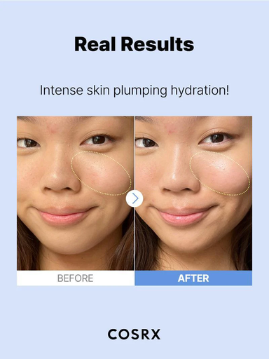 cosrx serum 2.png
