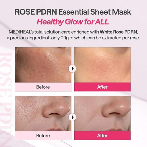 mediheal mask pdrn 4.jpg