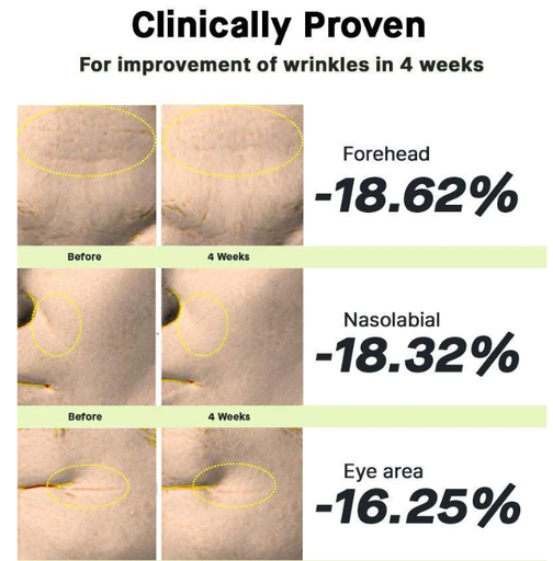 the retinol full resultados.png